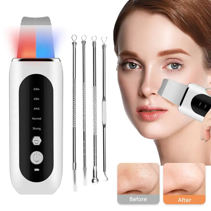SkinsSonic Derma Ultrasonic Skin Scrubber – Blackhead Remover & Exfoliator